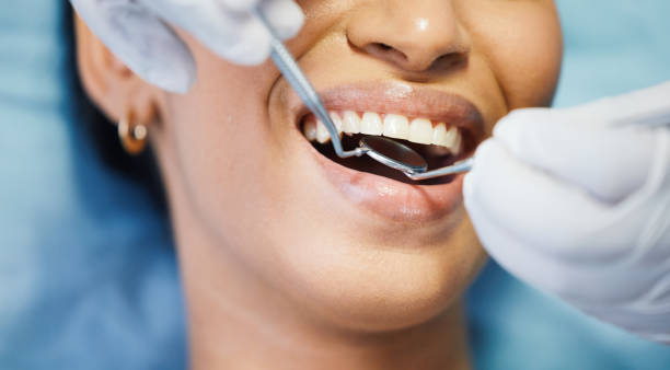 Best Emergency Denture Repair in Port Charlotte, FL